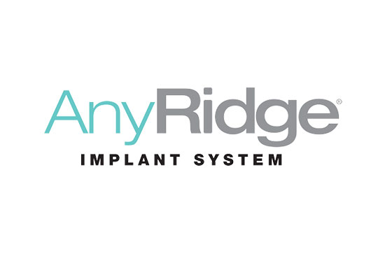 Anyridge
