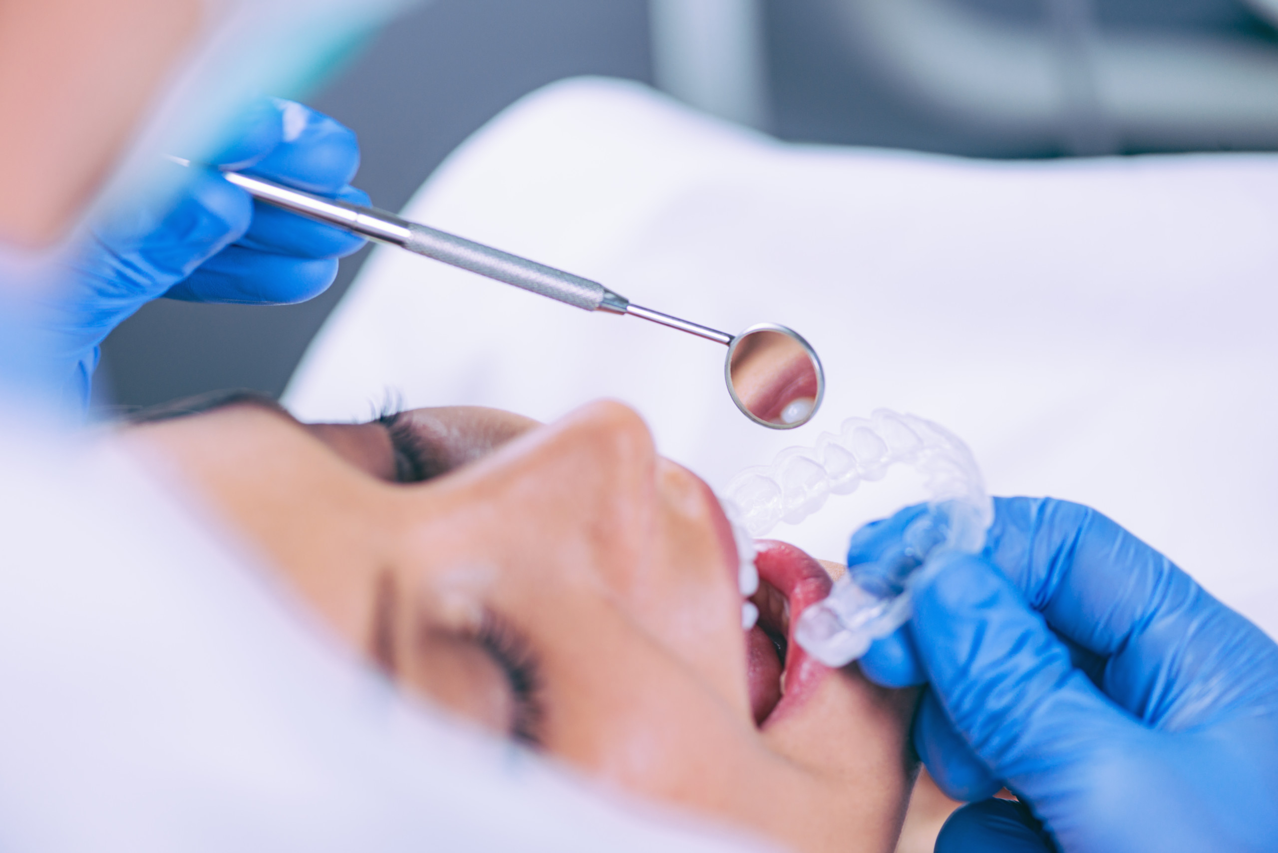 Teeth Whitening Procedure