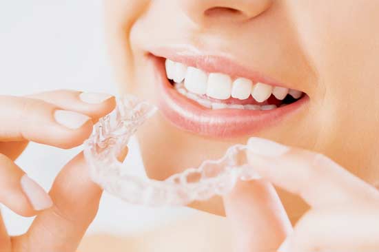 white-clinic-servicos-3 White Clinic serviços Branqueamento Dentário Teeth Whitening