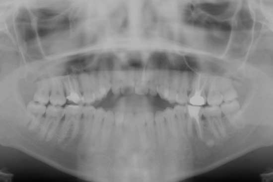 white-clinic-servicos-5 White Clinic serviços Dor e Oclusão Orofacial Pain and Orofacial Occlusion