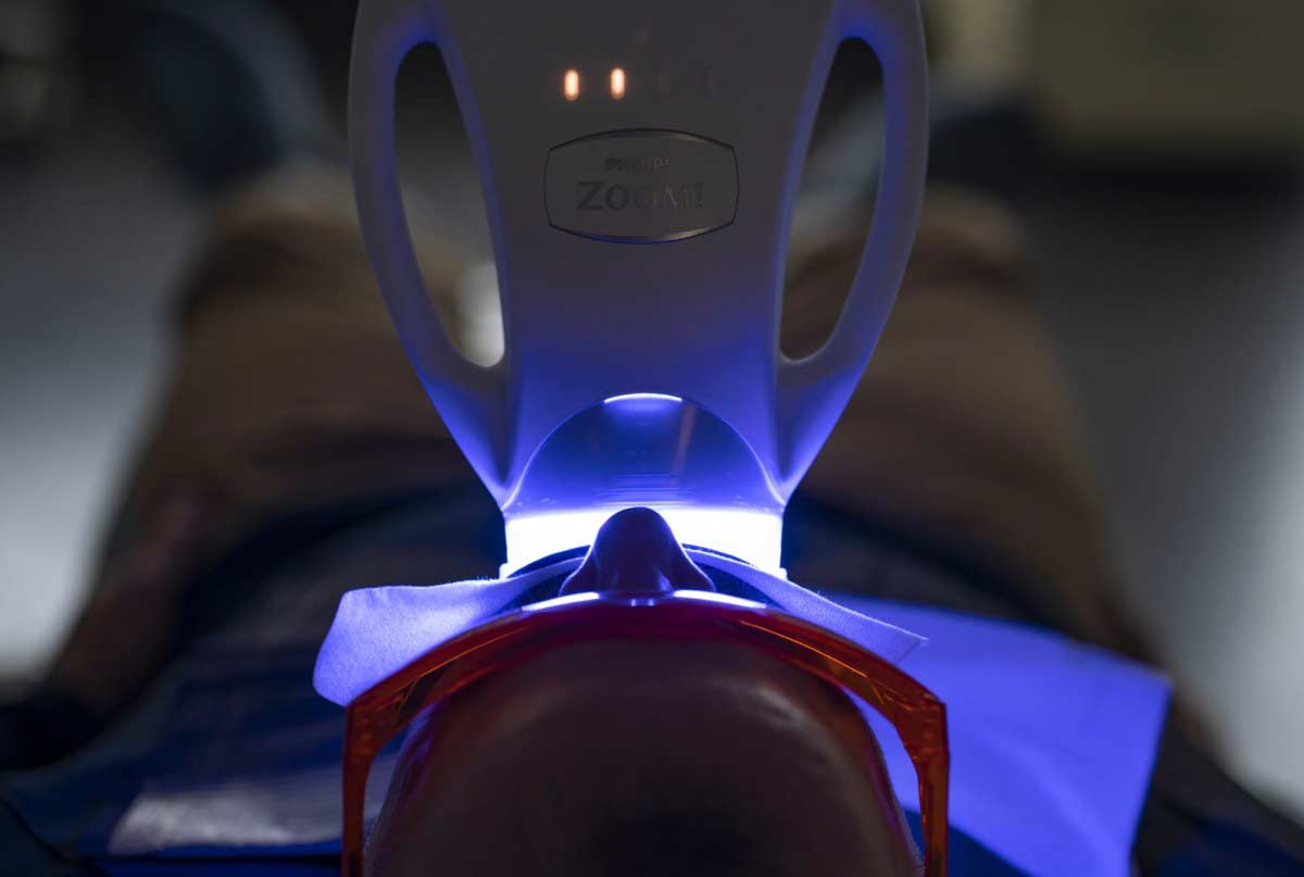 white-clinic-servicos-6 White Clinic serviços Cirurgia Oral Oral Surgery