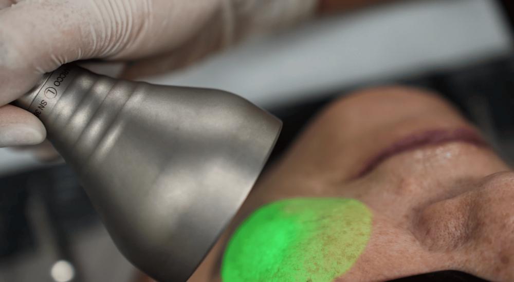 Fotona Aesthetic Lasers